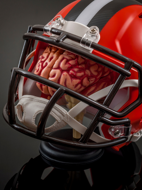 Photo of Area Schools Step Up Their Game With New Concussion Program
